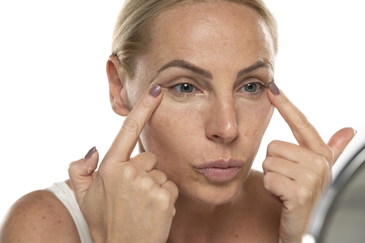 Woman with puffy face, eye treatment, eye wrinkles