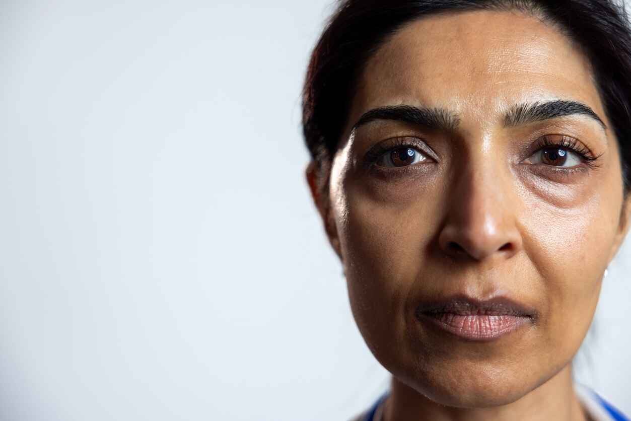 How to Cover Under-Eye Bags and Dark Circles