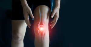 Exercises for cracking knees or knee pain
