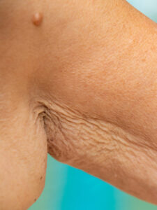 Best products for crepey skin