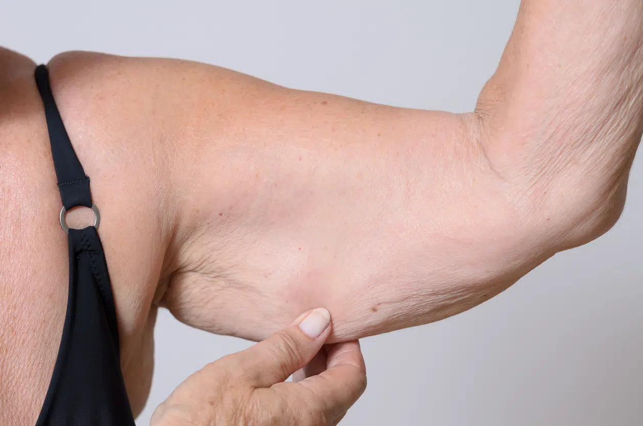 5 EASY EXERCISES TO TARGET FLABBY ARMS