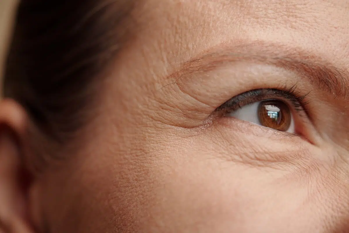 fine lines and wrinkles or signs of aging