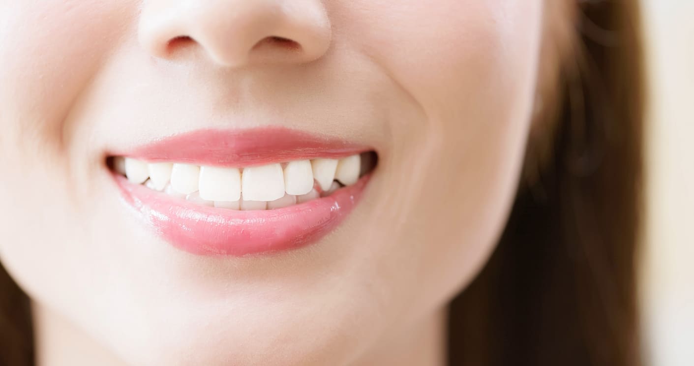 naturally whiten teeth