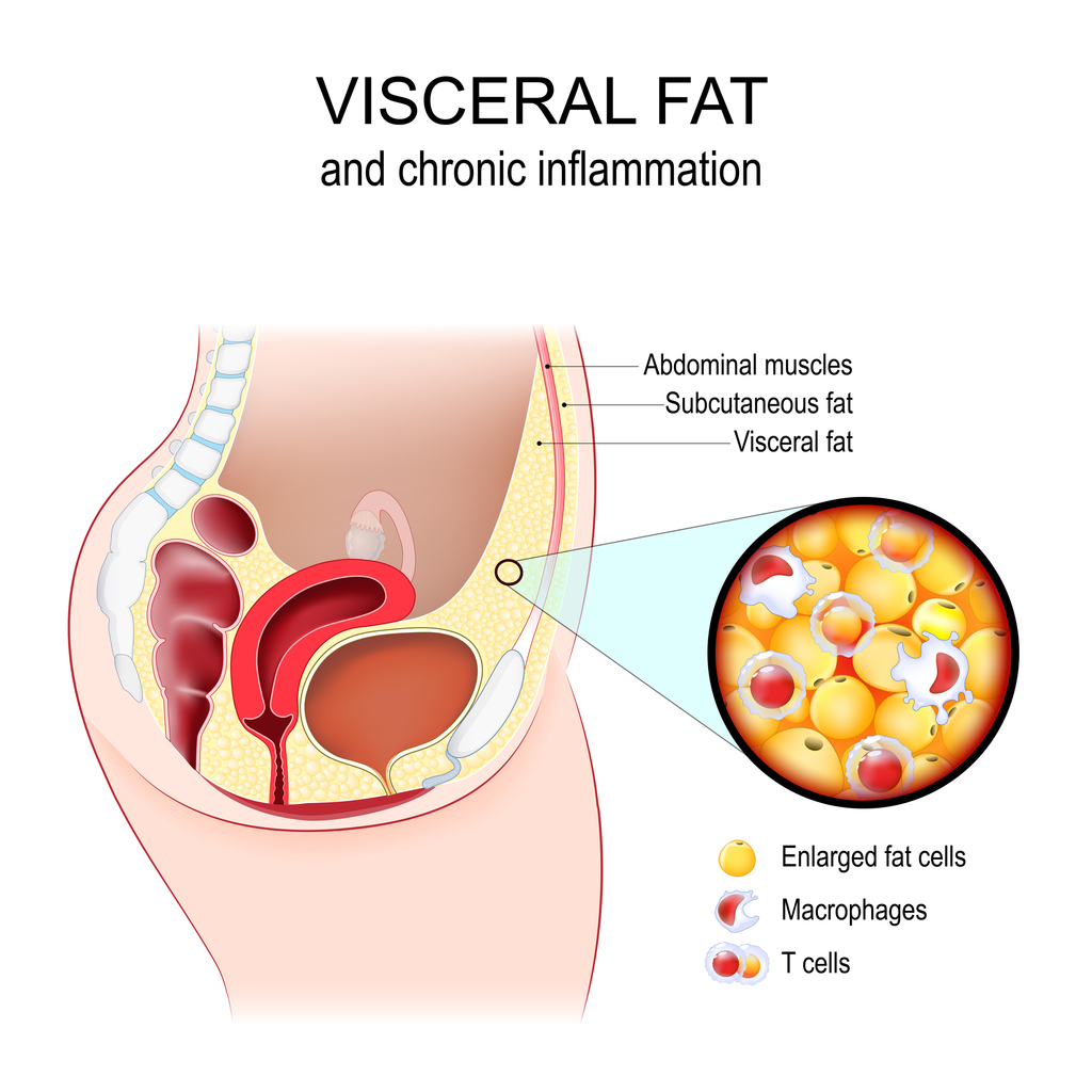 Visceral fat