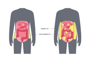 Visceral Fat
