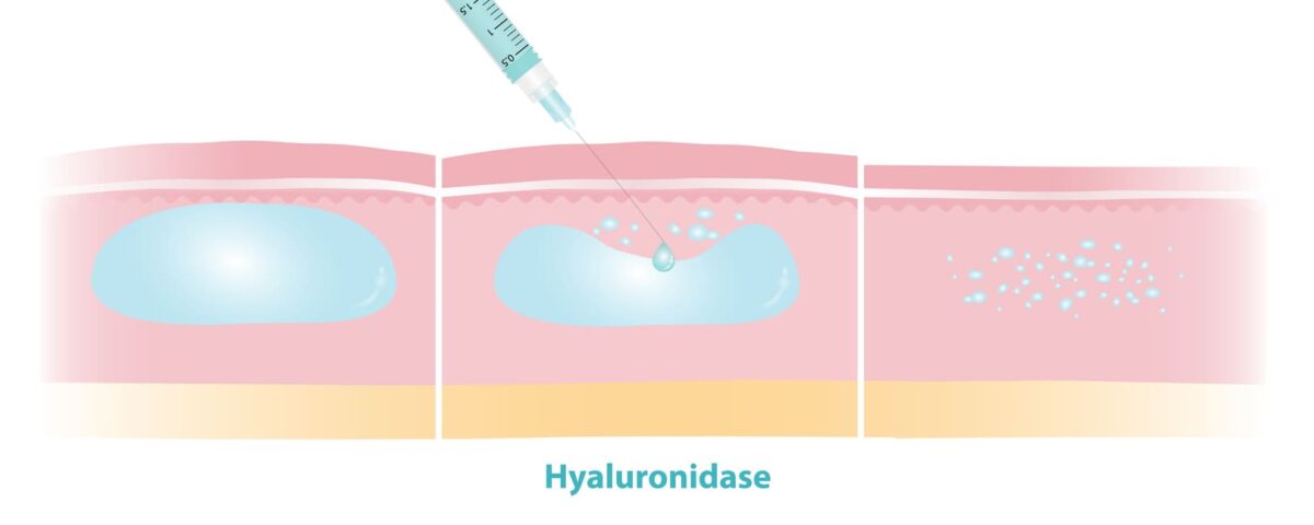 hyaluronidase graphic