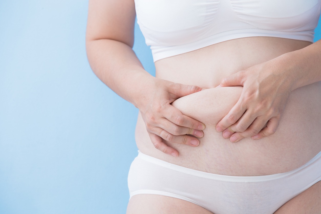 Skin Removal After Weight Loss