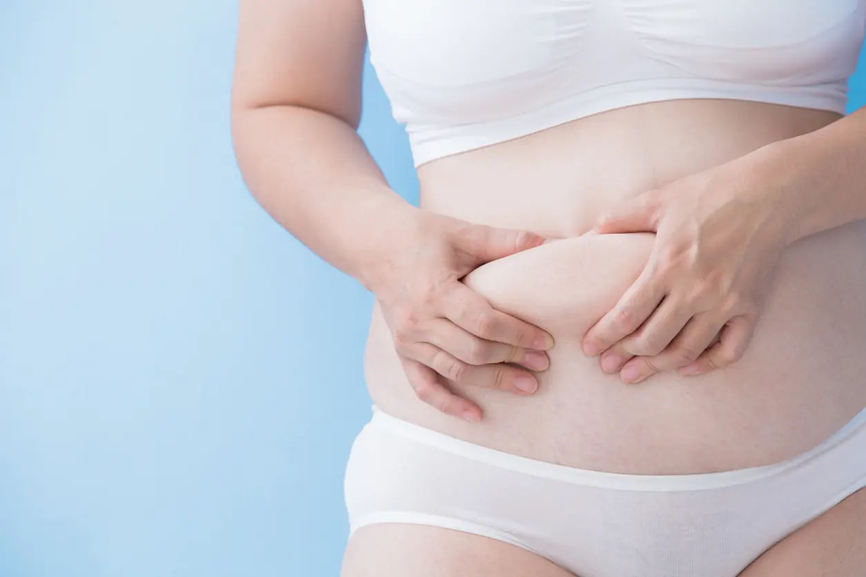 Skin Removal After Weight Loss