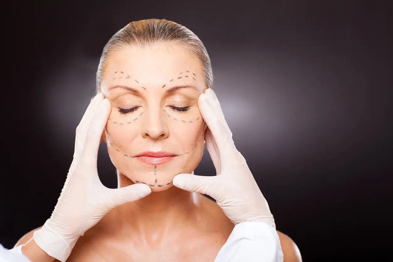 How a Deep Plane Face Lift Goes Beyond Skin Deep