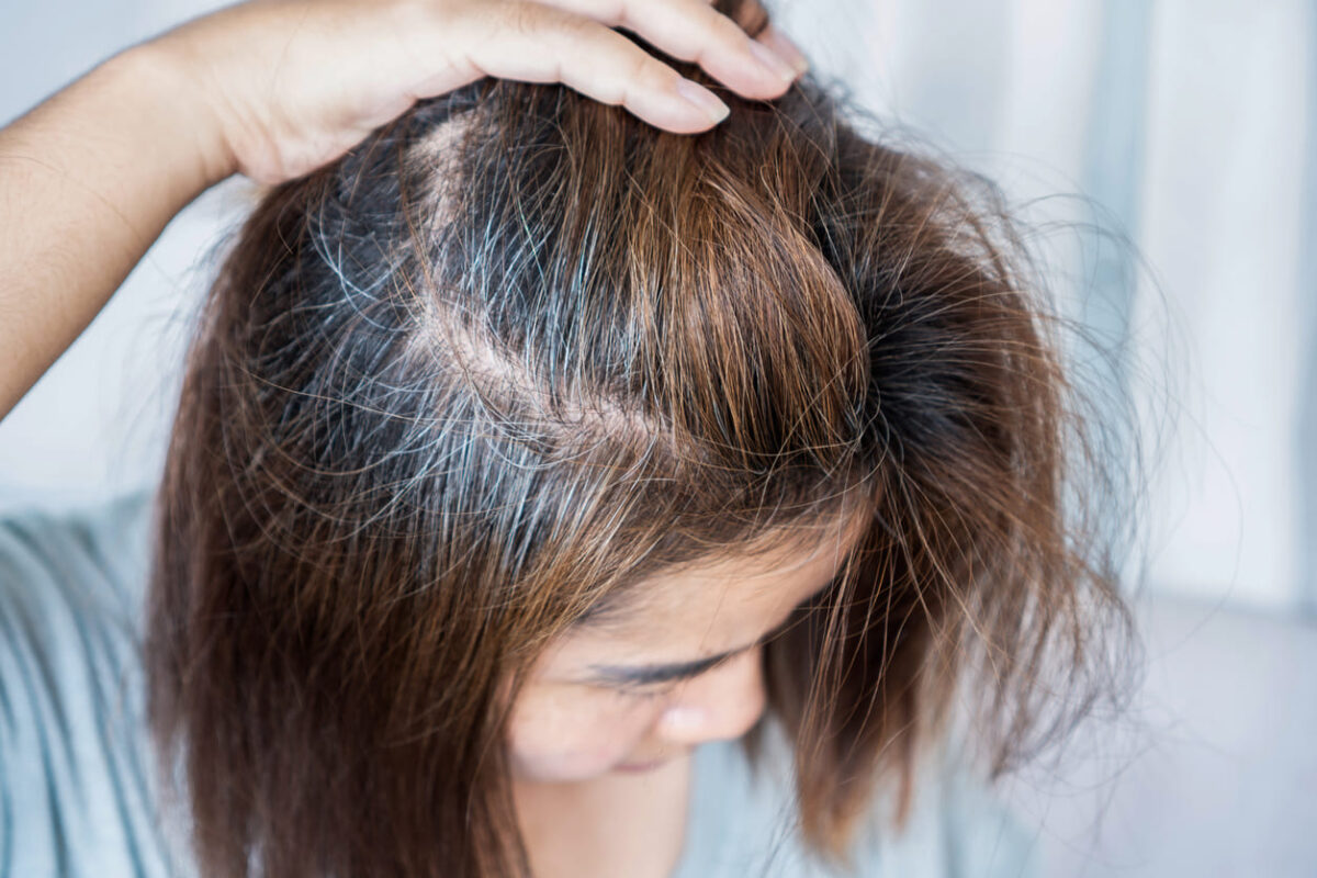 Thinning Hair After 50